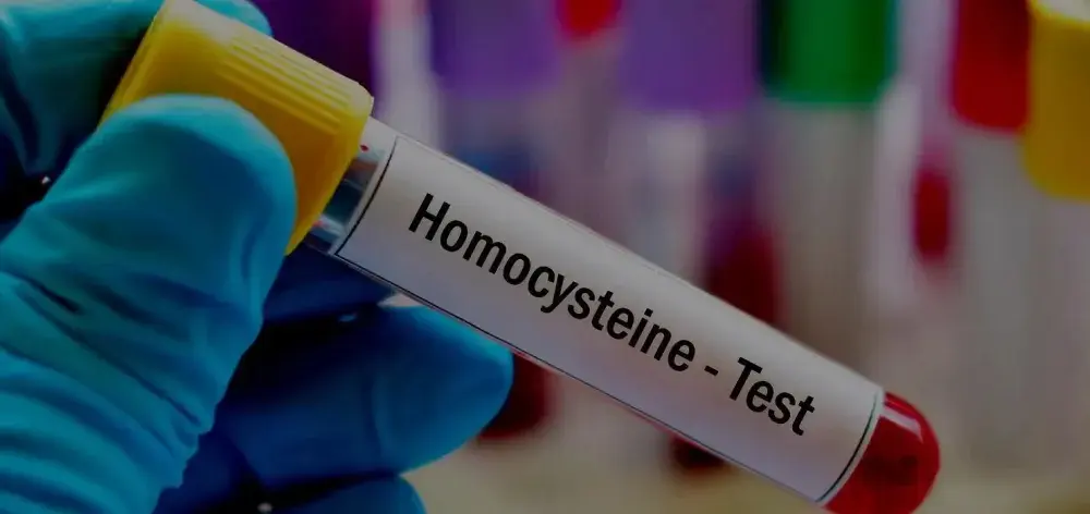Ile kosztuje badanie homocysteina? Sprawdź ceny i oszczędź pieniądze
