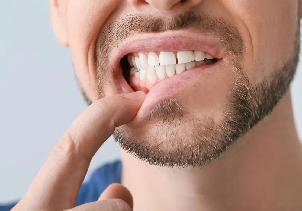 Diastema - Kiedy szpara między zębami to problem?