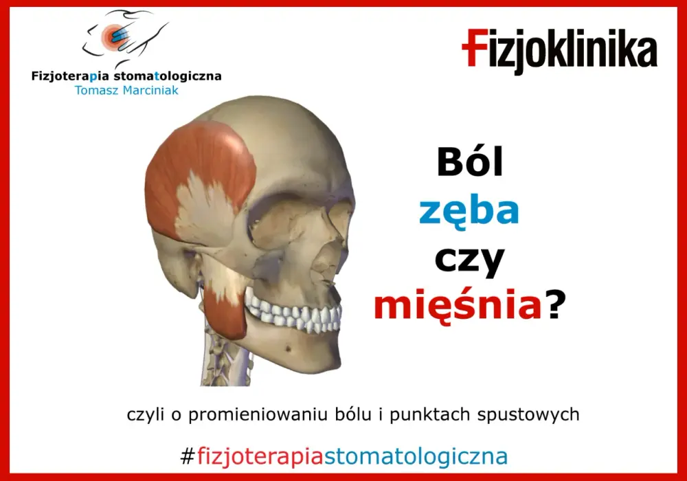 Napięta żuchwa – przyczyny i co naprawdę pomaga?