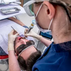 Laserowe usuwanie zębów na czym polega i dlaczego warto je wybrać