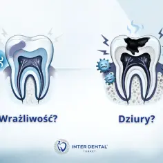 Zdrowy ząb vs ząb z próchnicą. Ząb reaguje na ciepło, co może oznaczać próchnicę.