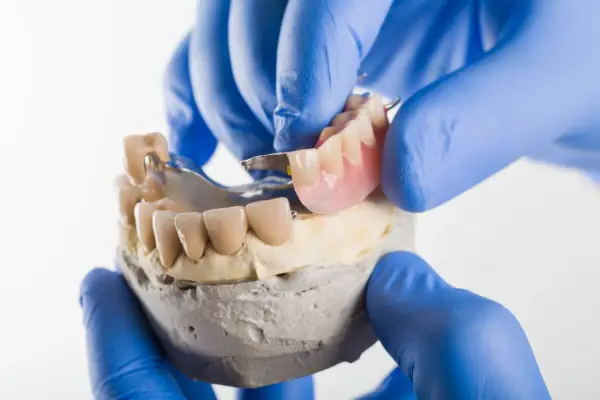 Proteza na zatrzaskach - ile kosztuje i kiedy warto ją wybrać?